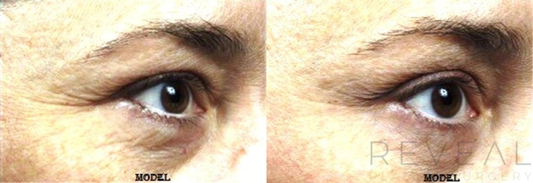 Before & After Skin Care Case 128 View #1 View in San Jose, CA